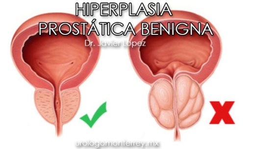 urologo urologia monterrey