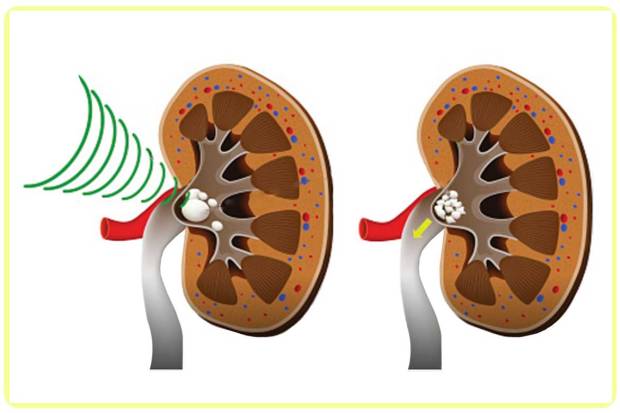 urologia urologo en monterrey