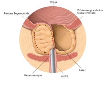 urologia urologo en monterrey