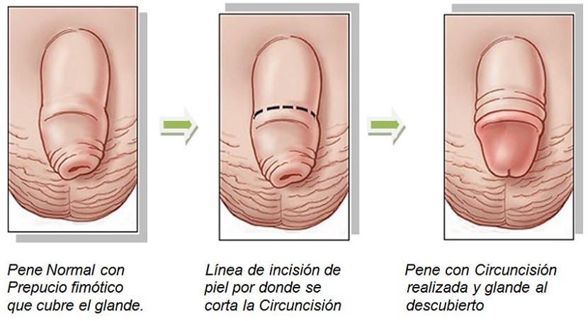 urologia urologo en monterrey