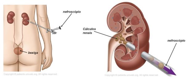 urologia urologo en monterrey