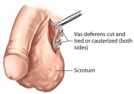 urologia urologo en monterrey